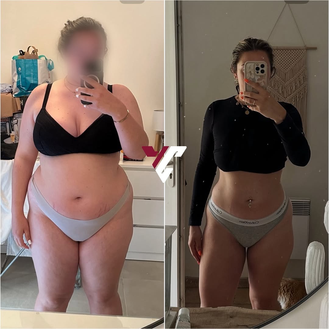 Transformation avant/après